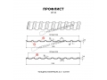 Профлист Металл Профиль МП-20x1100-R (ПЭ-01-1014-0,45)